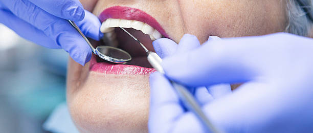 Best Weekend Emergency Dentist in Napervle, IL